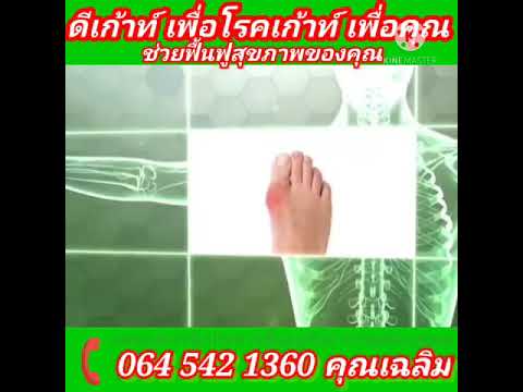 โรคเกาท์มีกรดยูริคสูง ต้อง D-COUT ช่วยคุณได้