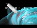 hepatic biopsy