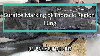 Surface Anatomy Of Lung Viva Voce Of Anatomy