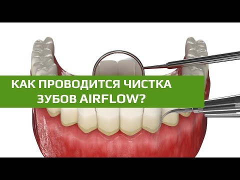 Что такое чистка зубов аэрфлоу Что такое чистка зубов аэрфлоу