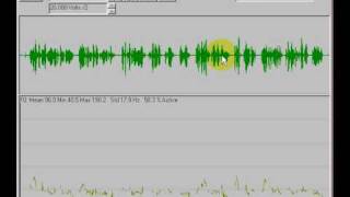 Tasko Speech Lab Speaking Fundamental Frequency