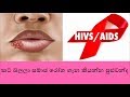 Sexually transmitted diseases and Oral cavity - HIV sinhala - Lingika roga - Sl notes