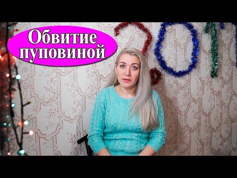 Роды при тройном обвитии Роды при тройном обвитии