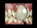 Dr. Ron Hayes: Perio/Gum disease