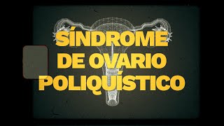 Síndrome De Ovario Poliquístico Carolina Novoa