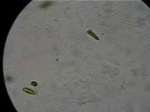 medical significance of euglena