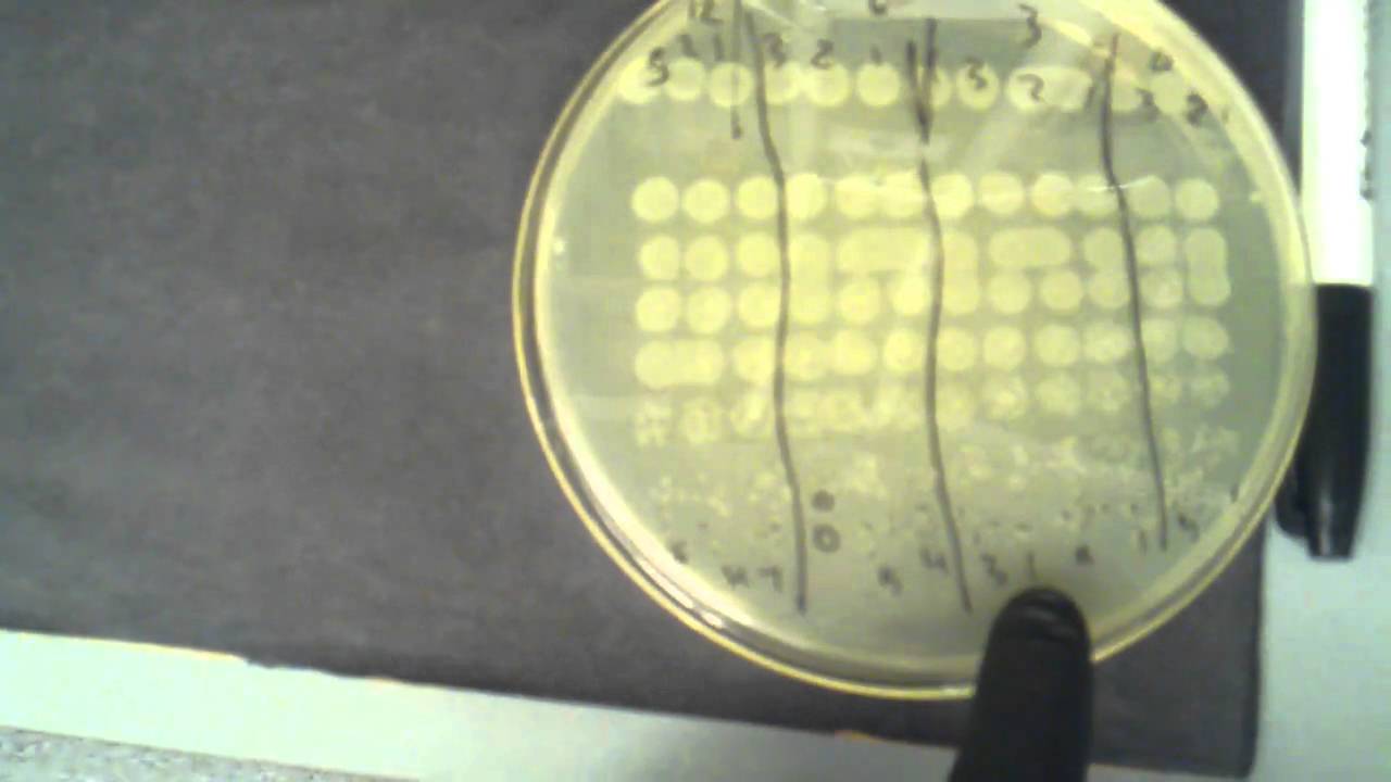 serial dilution lab report microbiology