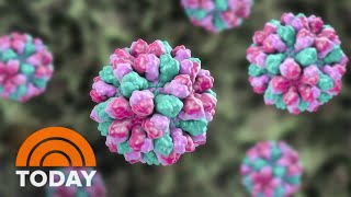 Norovirus outbreak in US: How to avoid it, symptoms to look out for