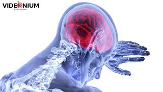 New Biomedical Cure for Memory Loss | Latest Research & Science News