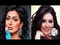 فنانات عربيات وقعن ضحايا عمليات التجميل... لن تتخيل ماذا حدث لهم