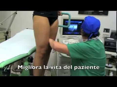 Operazione su vene che sopportano SPb