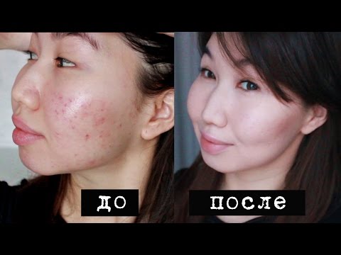 Сигна от оксимирона как сделать Сигна от оксимирона как сделать