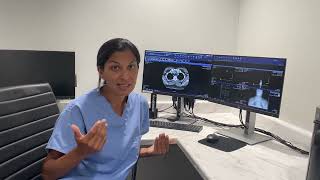 Mive, One-Sided Thyroid Goiter Found Incidentally - No Symptoms