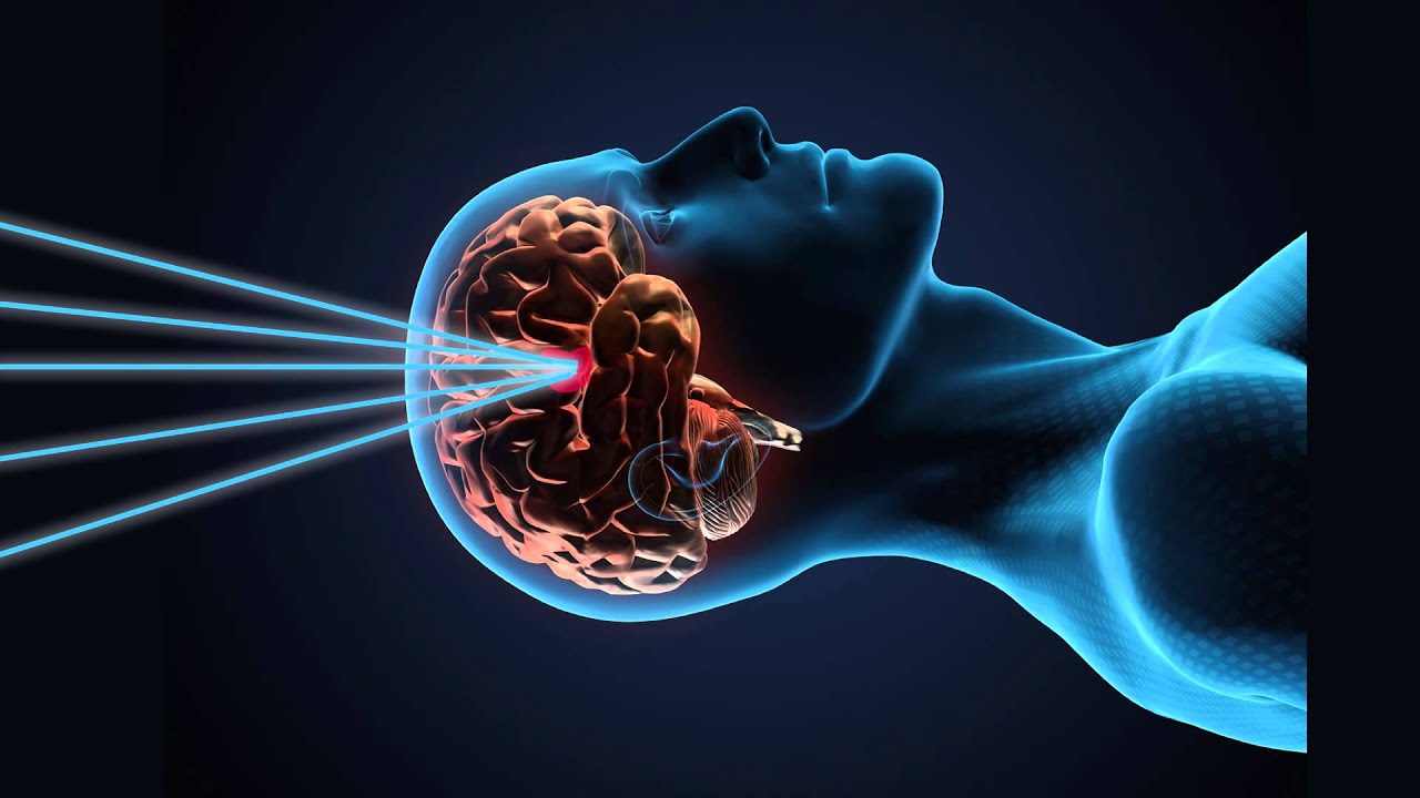 gamma knife at st joseph medical center youtube tacoma design
