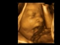 3D Ultrasound 30 weeks Yawning baby A New Conception 3D