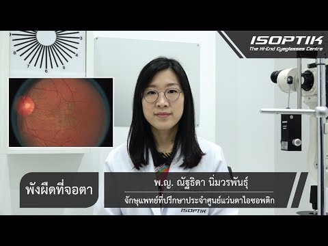 พังผืดที่จอตา