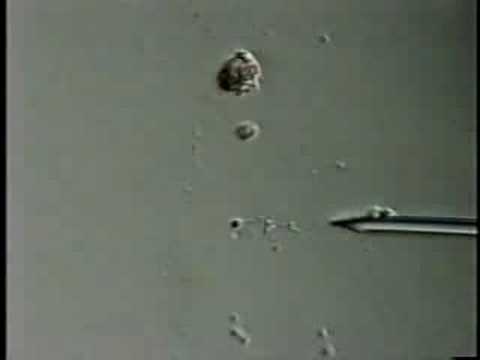 Diphallia+Disorder Diphallia Disorder http://www.digplanet.com/wiki/Sertoli_cell-only ...