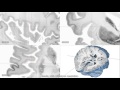 Ultra high Resolution 3D Human Brain Model (BigBrain) in Atelier3D Viewer