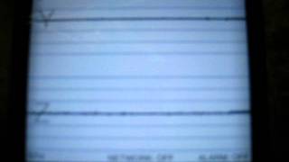 Watch Briggs Filtered video