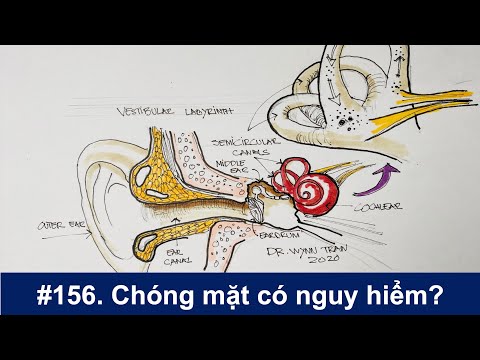 #156. Chóng mặt có nguy hiểm?