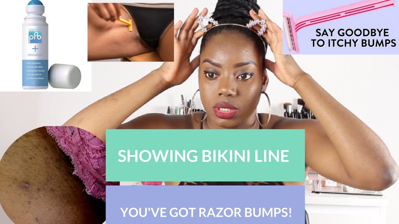 Prevent razor bumps bikini line