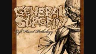 Watch General Surgery Decomposer video