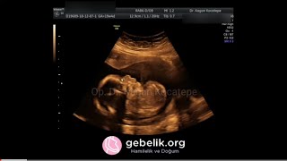 19,5 HAFTALIK ERKEK BEBEK DETAYLI ULTRASON, RENKLİ DOPPLER, RAHİM AĞZI KALINLIĞI ÖLÇÜMÜ (AÇIKLAMALI)