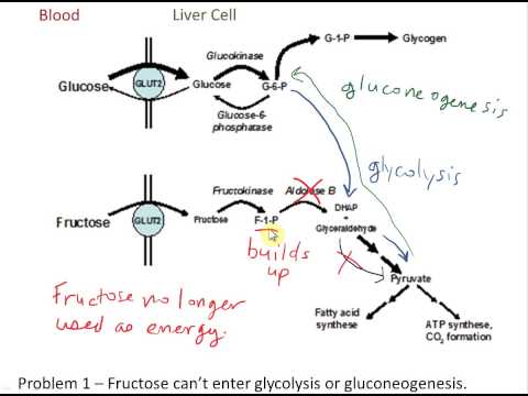 hereditary fructose intolerance