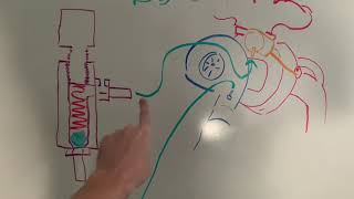 How a simple boost controller functions on a 2G DSM