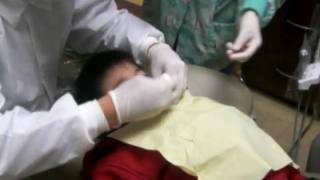Thady Wong - 2Nd Teeth Fall 022810.Avi