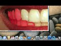 Adobe PS Tutorial - Whiten Teeth