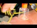 VENOM EXTRACTION - Centipede Bite Aftermath! download mp3 dan video VENOM EXTRACTION - Centipede Bite Aftermath!