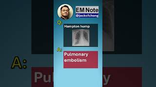Clinical Quiz 006