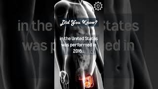 Interesting Facts About The First Transplant.