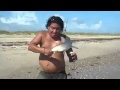 Baby Shark Bites Man's Chest
