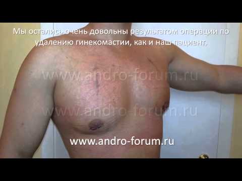 Увеличение груди после овуляции