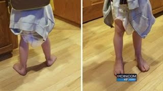 Longview elementary student sent home in diaper