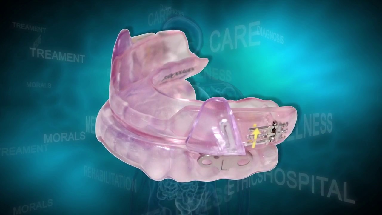 Sleep Apnea