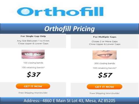 Orthofill Teeth Gap Bands