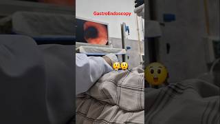 Camera Going Inside Stomach Through Oesophagus Endoscopy View