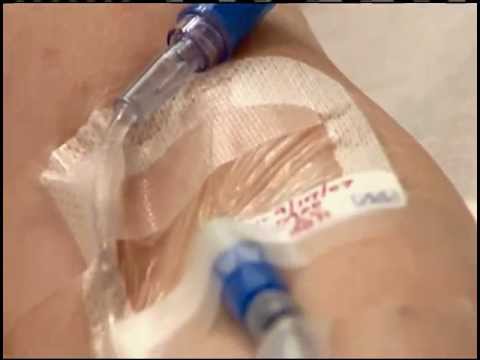 More Patient Deaths from Luer Misconnections