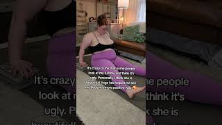 Its Crazy To Me That Some People Look At My Tummy And Think Its Ugly
