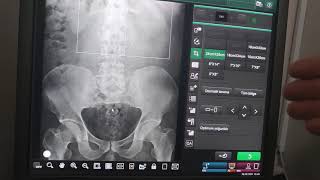 Düsg Direkt Ürüner Sistem Grafi Radyolojik Anatomik Anlatım Düsg Ve Adbg Arasında Fark Nedir?