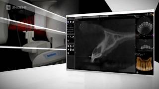 Carestream CS 9000 3D - дентальный цифровой томограф с функцией панорамного исследования