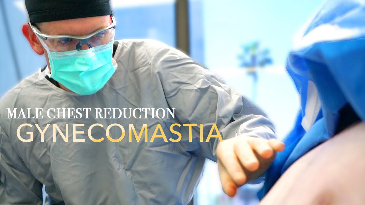 Male Chest Reduction | Gynecomastia | Gland Removal | Barrett Plastic Surgery | Beverly Hills Male Chest Reduction | Gynecomastia | Gland Removal | Barrett Plastic Surgery | Beverly Hills