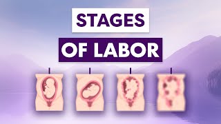 Understanding The Stages Of Labor