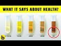 What The Color Of Your Urine Says About Your Health