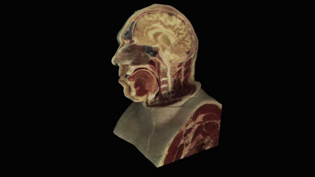The Visible Human Project - head of male cadaver - YouTube