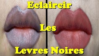 Eclaircir Les Levres Noires