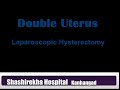 Double Uterus - Laparoscopic hysterectomy